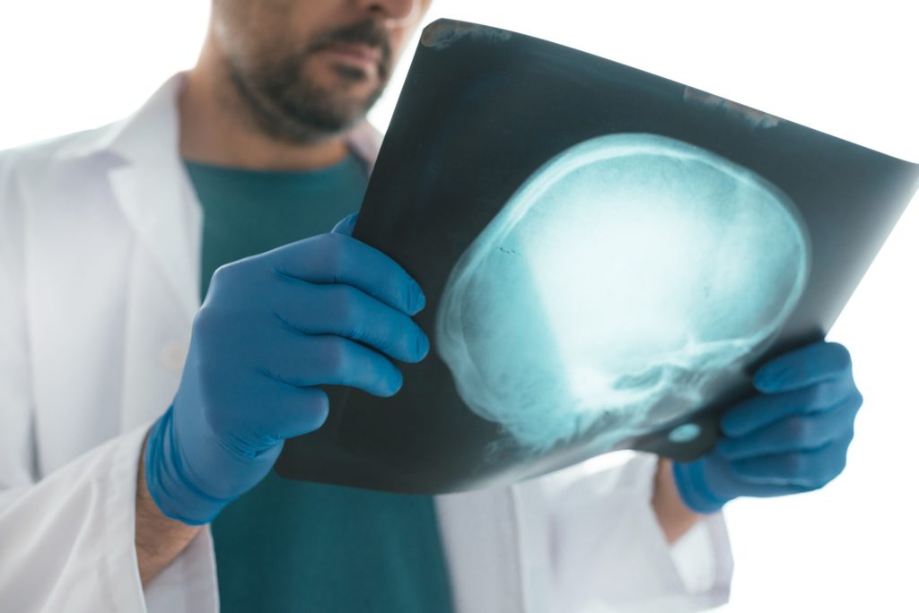 Doctor examining x-ray of the skull